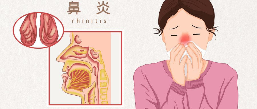 鼻子不通气鼻塞怎么办？风油精擦鼻唇沟处有什么好处吗